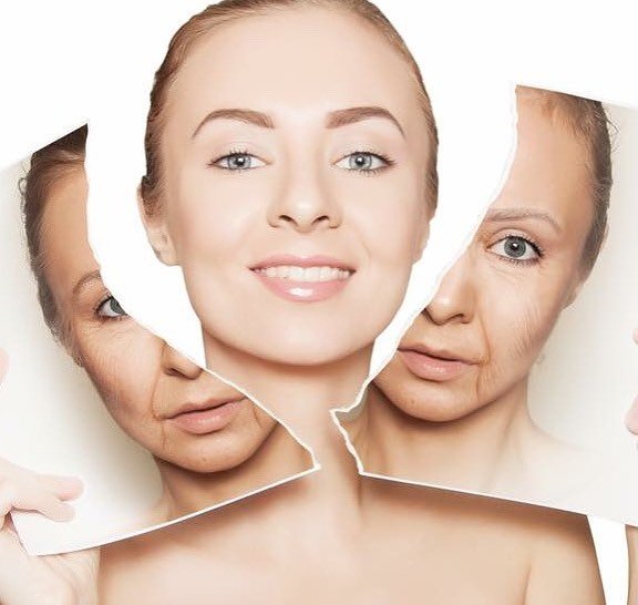 Căng chỉ collagen phù hợp với người có dấu hiệu lão hóa da ở mức độ vừa phải